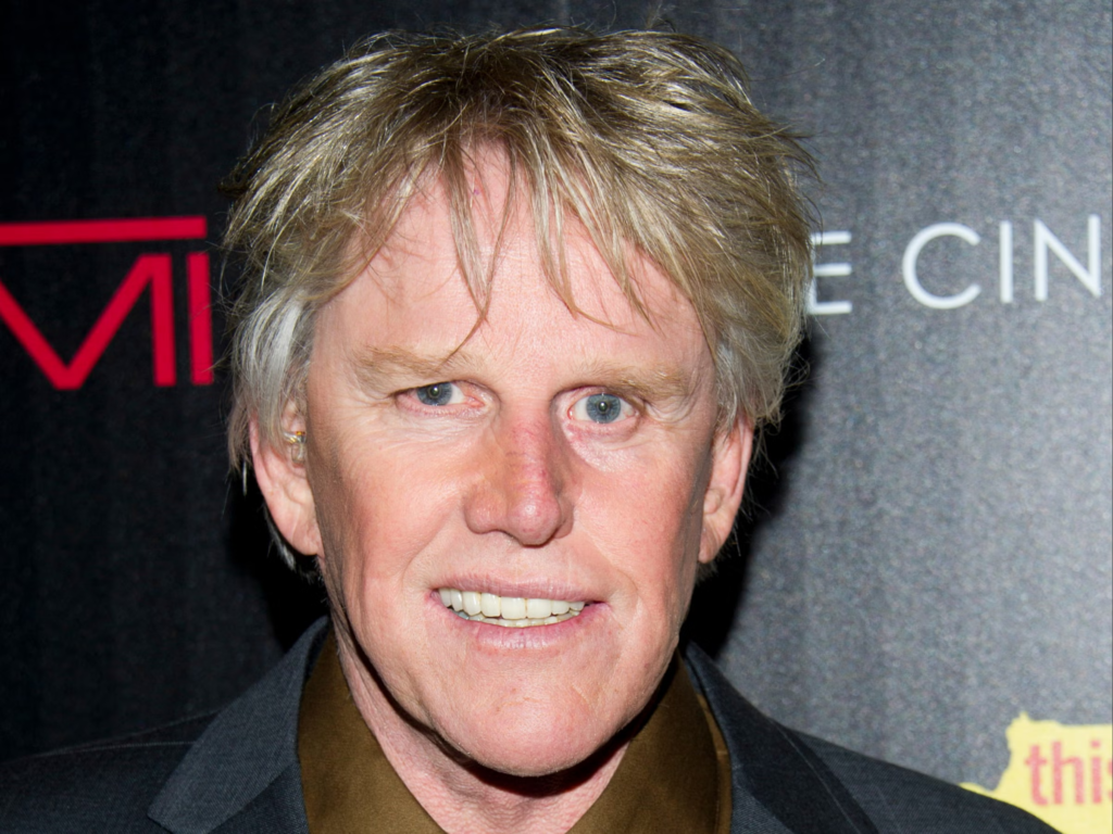 Gary Busey teeth
