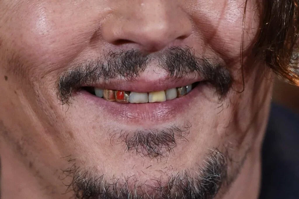 Johnny Depp Teeth