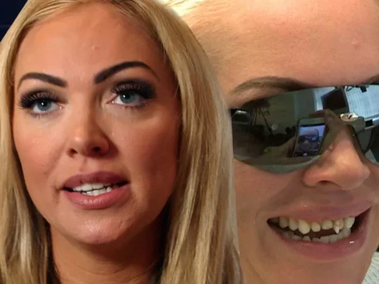 Aisleyne Horgan Wallace Teeth Before After