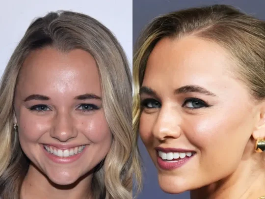 Madison Iseman Teeth Before and After – Flawless White