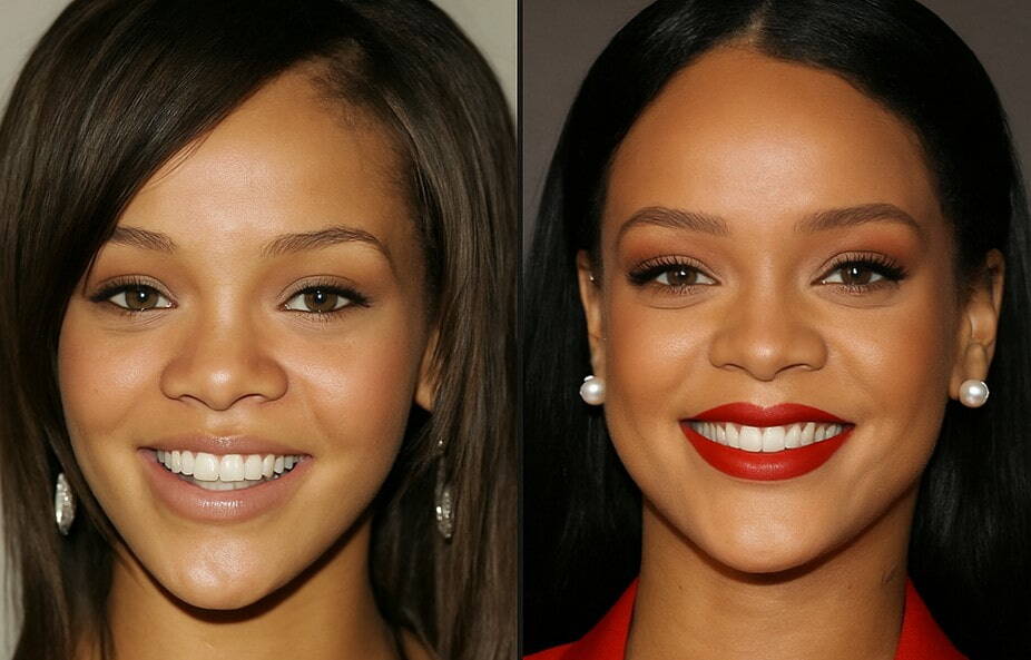 Rihanna smile and teeth