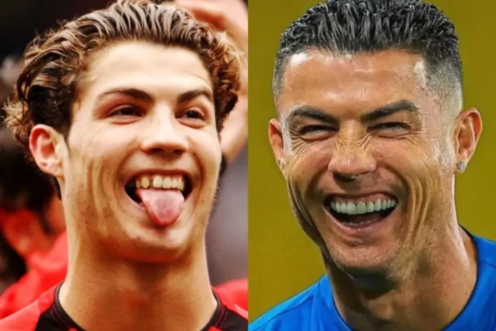 Cristiano Ronaldo Teeth before after