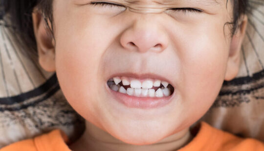 How to Stop Baby Grinding Teeth During the Day