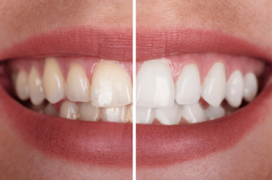 Dental Reconstruction: What Is It and When Is It Necessary?